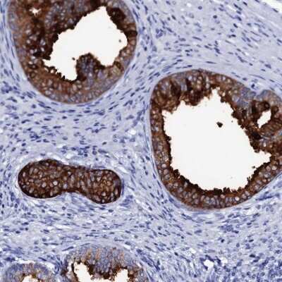 Immunohistochemistry: SSFA2 Antibody [NBP2-48718]