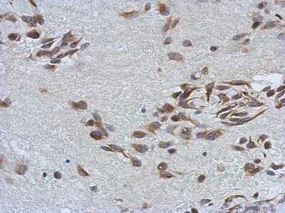 Immunohistochemistry-Paraffin: SSFA2 Antibody [NBP2-15128]