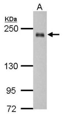 Western Blot: SSFA2 Antibody [NBP2-15128]