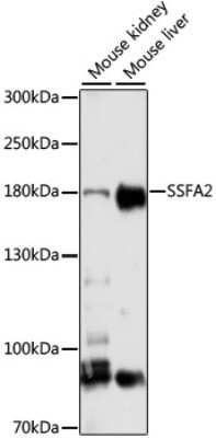 Western Blot: SSFA2 AntibodyAzide and BSA Free [NBP2-93018]