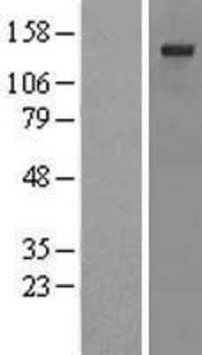 Western Blot: SSFA2 Overexpression Lysate [NBL1-16469]