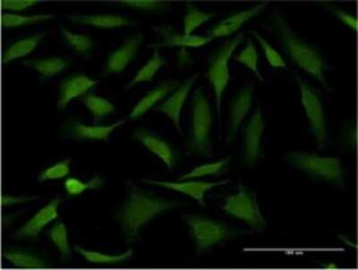 Immunocytochemistry/ Immunofluorescence: SSH1 Antibody (1D2) [H00054434-M02]