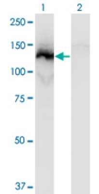 Western Blot: SSH1 Antibody (2F9) [H00054434-M12]