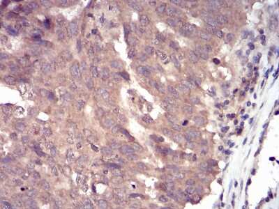 Immunohistochemistry-Paraffin: SSH1 Antibody (6C11G9) - BSA Free [NBP2-52568]