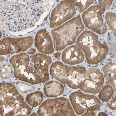 Immunohistochemistry-Paraffin: SSH1 Antibody [NBP1-89604]