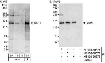 Western Blot: SSH1 Antibody [NB100-60671]