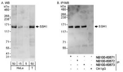 Western Blot: SSH1 Antibody [NB100-60673]