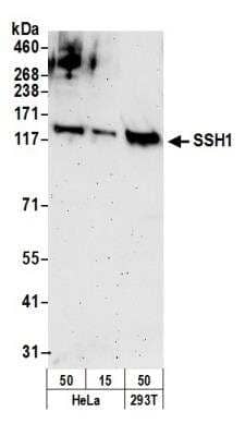 Western Blot: SSH1 Antibody [NB100-60673]