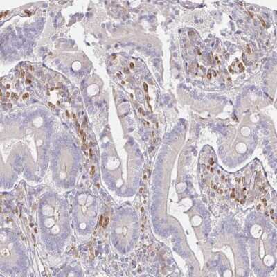 Immunohistochemistry-Paraffin: SSH2 Antibody [NBP2-49245]