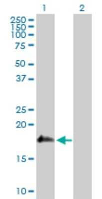 Western Blot: SSH2 Antibody [H00085464-D01P]