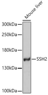 Western Blot: SSH2 AntibodyBSA Free [NBP2-94344]