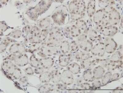 Immunohistochemistry-Paraffin: SSH3 Antibody (6F9) [H00054961-M01]