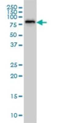 Western Blot: SSH3 Antibody (6F9) [H00054961-M01]