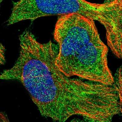 Immunocytochemistry/ Immunofluorescence: SSH3 Antibody [NBP1-83805]