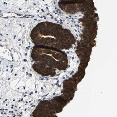 Immunohistochemistry-Paraffin: SSH3 Antibody [NBP1-83804]