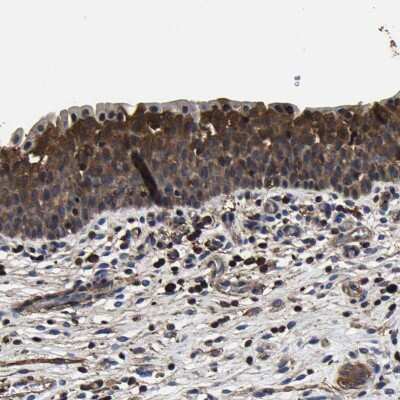 Immunohistochemistry-Paraffin: SSH3 Antibody [NBP1-83805]