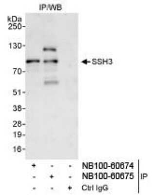 Immunoprecipitation: SSH3 Antibody [NB100-60674]