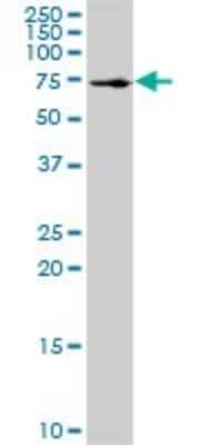Western Blot: SSH3 Antibody [H00054961-D01P]