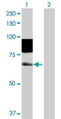 Western Blot: SSH3 Antibody [H00054961-D01P]