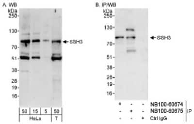 Western Blot: SSH3 Antibody [NB100-60675]