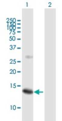 Western Blot: SSNA1 Antibody [H00008636-B01P]