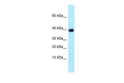 Western Blot: SSNA1 Antibody [NBP2-84285]