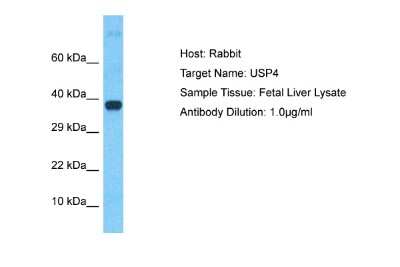 Western Blot: SSNA1 Antibody [NBP2-84286]