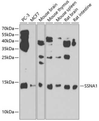 Western Blot: SSNA1 AntibodyBSA Free [NBP2-93643]