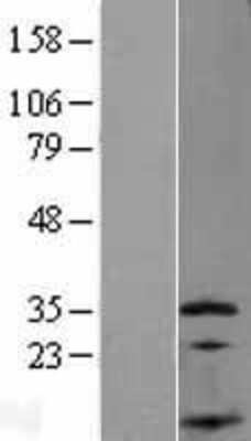 Western Blot: SSNA1 Overexpression Lysate [NBP2-07961]