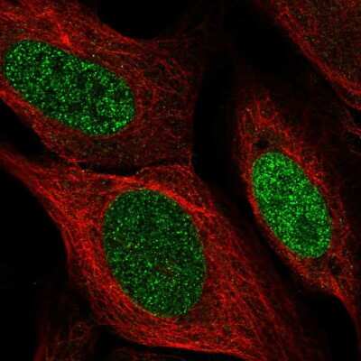 Immunocytochemistry/ Immunofluorescence: SSPN Antibody [NBP2-56991]