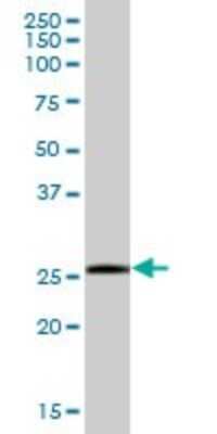 Western Blot: SSPN Antibody [H00008082-B02P]