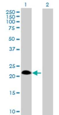 Western Blot: SSPN Antibody [H00008082-B02P]