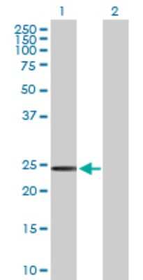 Western Blot: SSPN Antibody [H00008082-D01P]