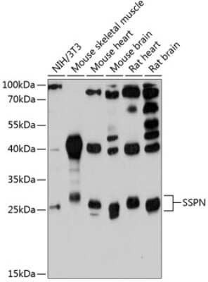 Western Blot: SSPN AntibodyAzide and BSA Free [NBP2-93891]