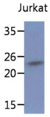 Western Blot: SSR2 Antibody (31G6)BSA Free [NBP2-42647]