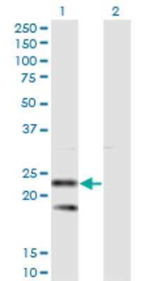 Western Blot: SSR2 Antibody (4C1) [H00006746-M01]