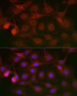 Immunocytochemistry/ Immunofluorescence: SSR2 Antibody - Azide and BSA Free [NBP3-16018]