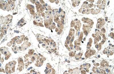 Immunohistochemistry: SSR2 Antibody [NBP1-69471]
