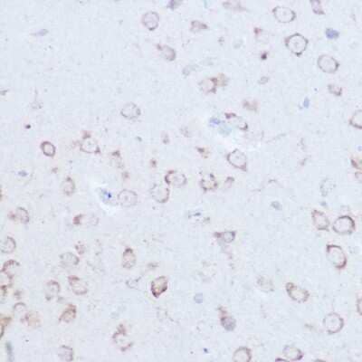 Immunohistochemistry-Paraffin: SSR2 Antibody - Azide and BSA Free [NBP3-16018]