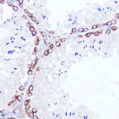Immunohistochemistry-Paraffin: SSR2 Antibody - Azide and BSA Free [NBP3-16018]