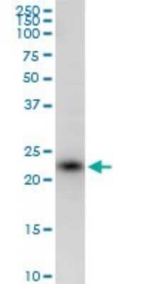 Western Blot: SSR2 Antibody [H00006746-B01P]