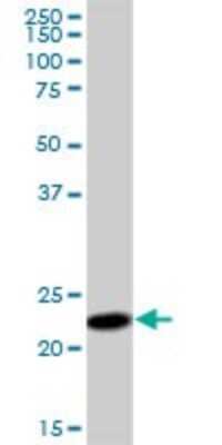 Western Blot: SSR2 Antibody [H00006746-B01P]