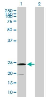 Western Blot: SSR2 Antibody [H00006746-B01P]