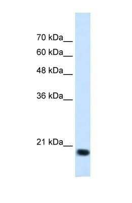 Western Blot: SSR2 Antibody [NBP1-69471]