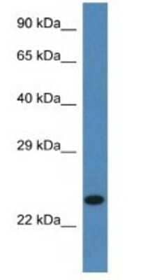 Western Blot: SSR2 Antibody [NBP1-74209]