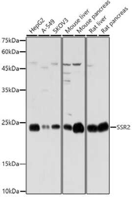 Western Blot: SSR2 AntibodyAzide and BSA Free [NBP3-16018]