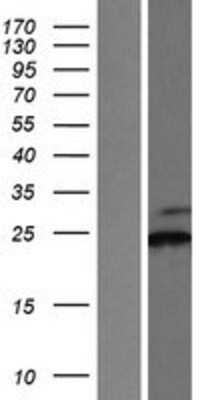 Western Blot: SSR2 Overexpression Lysate [NBP2-08032]