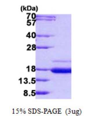 SDS-PAGE: Recombinant Human SSR2 His Protein [NBP2-23474]