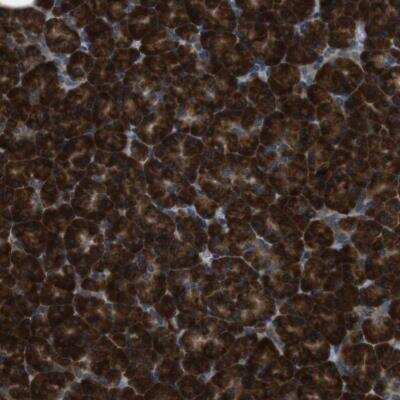 Immunohistochemistry-Paraffin: SSR3 Antibody [NBP1-80667]
