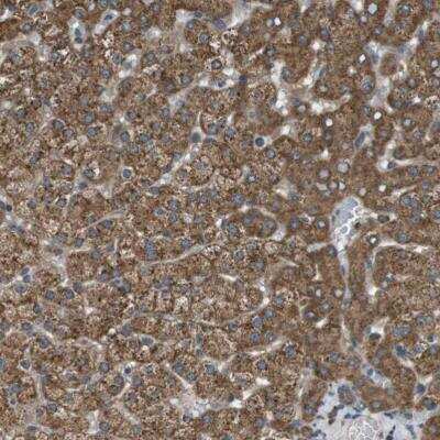 Immunohistochemistry-Paraffin: SSR3 Antibody [NBP1-80667]